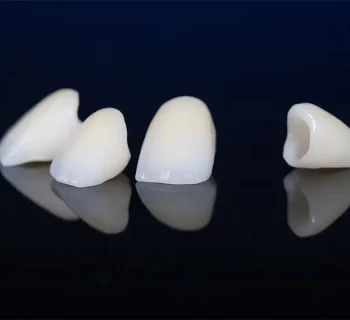 Dental Crown Aftercare: Foods to Eat and Avoid in the First Week