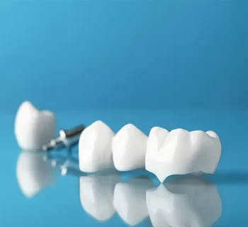 Cracked or Broken Tooth in Wasilla, Alaska? Here’s When You Need a Dental Crown Fast